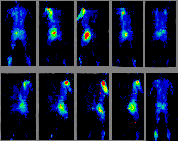 Elstar Elektronic AG Body Pressure Measurement System (BPMS) Research